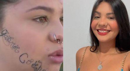 Jovem tatuada no rosto à força pelo ex diz que evitava se olhar no espelho, mas hoje vive nova fase