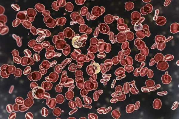 Mieloma múltiplo: tratamento no SUS está 20 anos atrasado, diz médico