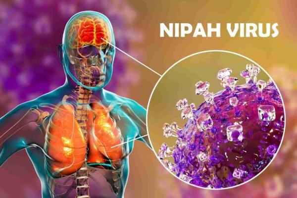 Nipah: quais são os sintomas do vírus que levou Índia ao lockdown