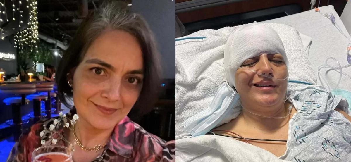 Mulher que teve câncer cerebral faz alerta para sintoma silencioso