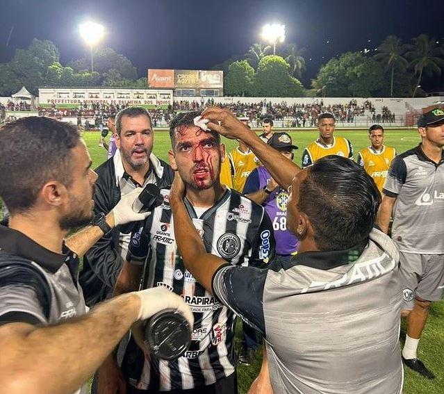 Jogador ex-América sofre corte na cabeça por lata arremessada por torcedor