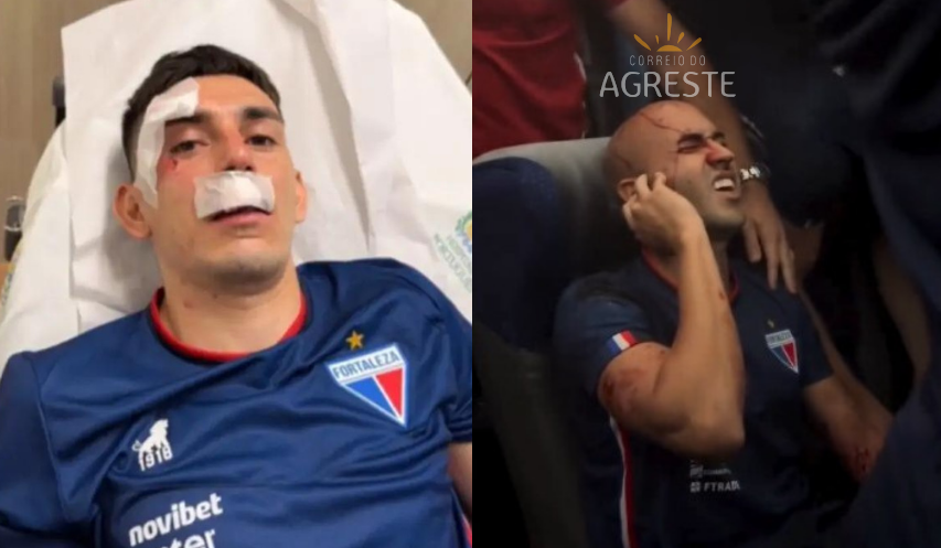 Ônibus do Fortaleza é atingido por pedras e bomba caseira e jogadores ficam feridos